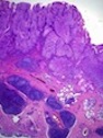 e5tw